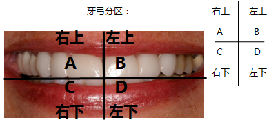 牙位记录法部位图片