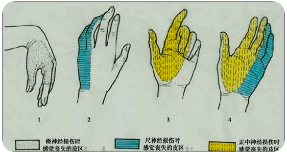 尺爪桡垂腕口诀图片