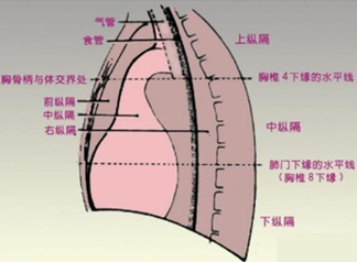 胸腺肿瘤位置图图片